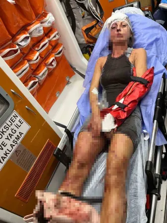 Antalya’da Can Pazarı: “Yere Düştüm, Vurmaya Devam Etti!”